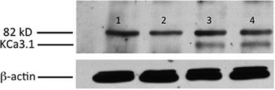 Modulation of Retrograde Trafficking of KCa3.1 in a Polarized Epithelium